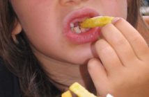 Fettleibige Kinder: WHO will Werbe-Einschränkung Kind isst Pommes